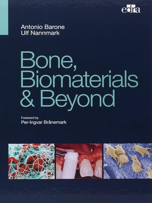 cover image of Bone, Biomaterials & Beyond